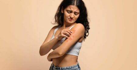 Vous avez des problèmes de peau ? Consultez un guérisseur magnétiseur !